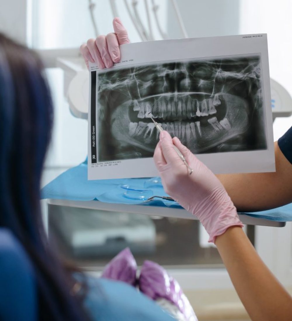kanal_tedavisi_endodonti_lema_dis_ankara kanal_tedavisi_endodonti_lema_dis_ankara